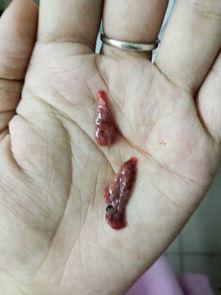 吃瓜会导致流产吗视频讲解,视频讲解带你了解孕期禁忌